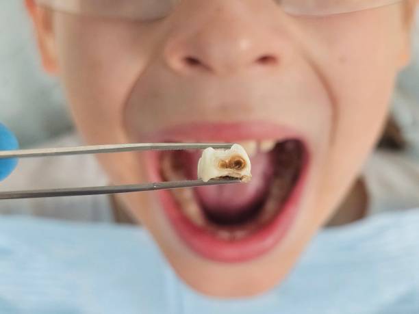 Best 24-Hour Emergency Dental Care in Canadian Lakes, MI